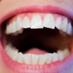 Prześliczne zdrowe zęby dodatkowo godny podziwu cudny uśmieszek to powód do dumy.